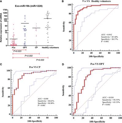 Plasma-Derived Exosome MiR-19b Acts as a Diagnostic Marker for Pancreatic Cancer